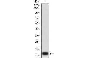Image no. 3 for anti-Purinergic Receptor P2Y, G-Protein Coupled, 1 (P2RY1) antibody (ABIN5611276)