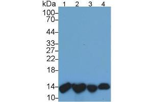 beta-2-Microglobulin (B2M) ELISA Kit