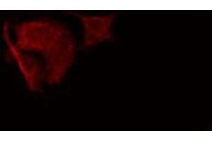 Image no. 2 for anti-Sarcoglycan, alpha (50kDa Dystrophin-Associated Glycoprotein) (SGCA) (Internal Region) antibody (ABIN6258888)