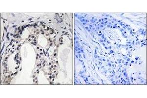 Image no. 1 for anti-Neurofibromin 2 (NF2) (AA 1-50), (pSer10) antibody (ABIN1532019)