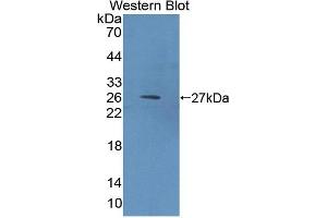 Image no. 1 for anti-Eukaryotic Translation Initiation Factor 2D (EIF2D) (AA 360-570) antibody (ABIN5013516)