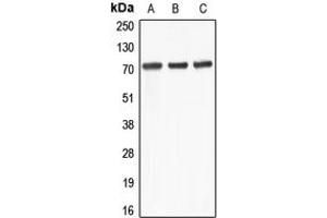 Image no. 2 for anti-ATP-Binding Cassette, Sub-Family D (Ald), Member 4 (ABCD4) (Center) antibody (ABIN2705374)