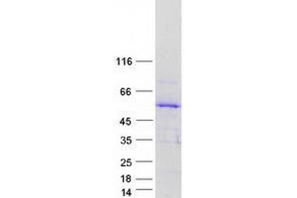 TSPYL5 Protein (TSPY-Like 5) (Myc-DYKDDDDK Tag)