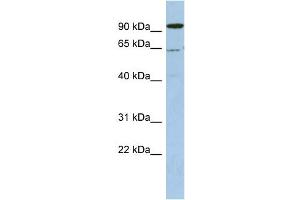 Image no. 1 for anti-DEAD (Asp-Glu-Ala-Asp) Box Polypeptide 52 (DDX52) (N-Term) antibody (ABIN2775208)