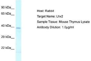Image no. 1 for anti-LIM Homeobox 2 (LHX2) (C-Term) antibody (ABIN2780619)