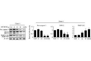 Image no. 5 for anti-Poly (ADP-Ribose) Polymerase 1 (PARP1) (Center) antibody (ABIN2854798)