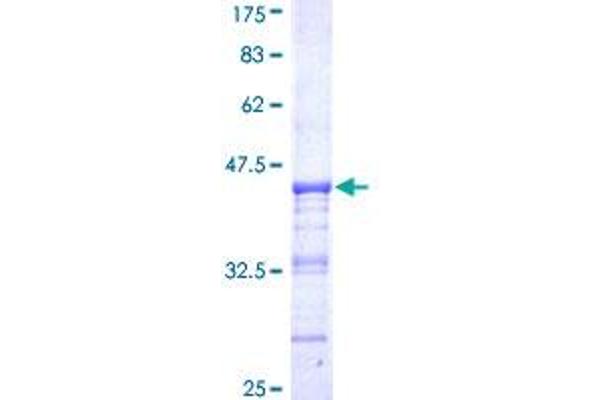 PJA1 Protein (AA 81-180) (GST tag)