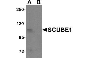 Image no. 2 for anti-Signal Peptide, CUB Domain, EGF-Like 1 (SCUBE1) (Middle Region) antibody (ABIN1031082)