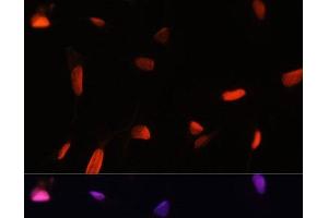 Immunofluorescence analysis of U2OS cells using ZNF346 Polyclonal Antibody at dilution of 1:100.