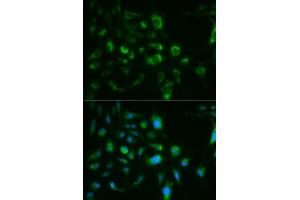 Image no. 2 for anti-Toll-Like Receptor 8 (TLR8) antibody (ABIN3022015)