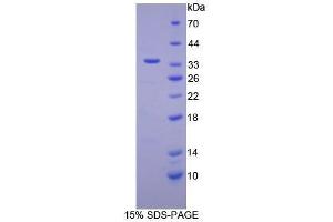 Image no. 1 for Retinol Binding Protein 3, Interstitial (RBP3) (AA 19-320) protein (His tag) (ABIN1080640)