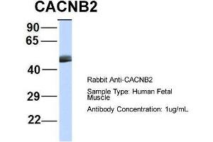 Image no. 2 for anti-Calcium Channel, Voltage-Dependent, beta 4 Subunit (CACNB4) (Middle Region) antibody (ABIN2774681)