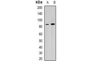 Image no. 1 for anti-Retinitis Pigmentosa GTPase Regulator (RPGR) antibody (ABIN2966997)