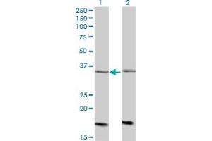 Image no. 1 for anti-AarF Domain Containing Kinase 4 (ADCK4) (AA 445-544) antibody (ABIN566410)