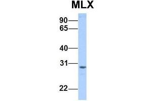 Image no. 2 for anti-MAX-Like Protein X (MLX) (Middle Region) antibody (ABIN2784559)