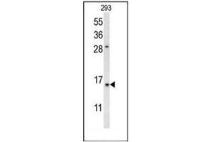Image no. 2 for anti-Regenerating Islet-Derived 3 alpha (REG3A) (AA 19-48), (N-Term) antibody (ABIN954505)