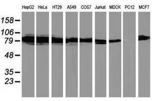 Image no. 2 for anti-Protein Kinase C, epsilon (PRKCE) antibody (ABIN1500229)