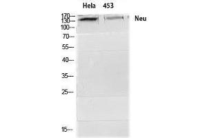 Image no. 2 for anti-Neuralized Homolog (Drosophila) (NEURL) (Ser357) antibody (ABIN3185835)