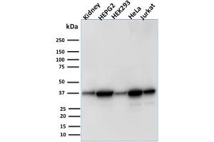 Image no. 1 for anti-Aldo-Keto Reductase Family 1, Member B1 (Aldose Reductase) (AKR1B1) antibody (ABIN6939403)