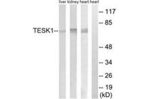 Image no. 1 for anti-Testis-Specific Kinase 1 (TESK1) (AA 181-230) antibody (ABIN1534852)