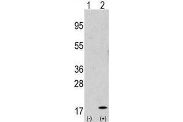 GABARAP antibody  (AA 1-30)