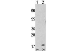 Western blot analysis of GABARAP antibody and 293 cell lysate either nontransfected (Lane 1) or transiently transfected with the GABARAP gene (2).