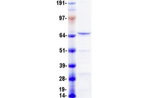 Image no. 1 for Neurofilament, Light Polypeptide (NEFL) protein (Myc-DYKDDDDK Tag) (ABIN2727131)