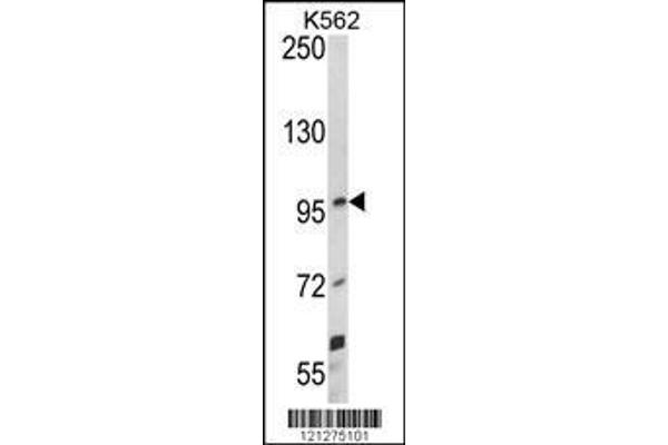 anti-Unc-5 Homolog C (C. Elegans) (Unc5c) (AA 188-217) antibody