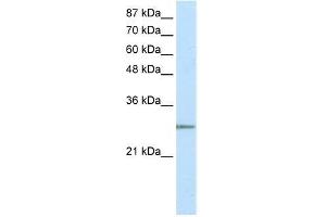 Image no. 1 for anti-MRG-Binding Protein (MRGBP) (N-Term) antibody (ABIN1108299)