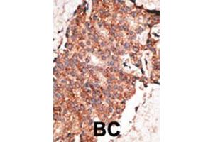 Image no. 1 for anti-Bone Morphogenetic Protein 1 (BMP1) (AA 957-986), (C-Term) antibody (ABIN388451)