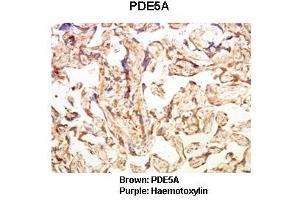 Image no. 2 for anti-phosphodiesterase 5A, cGMP-Specific (PDE5A) (C-Term) antibody (ABIN2789423)