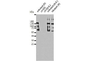 Image no. 1 for anti-Roundabout, Axon Guidance Receptor, Homolog 4 (ROBO4) (full length) antibody (ABIN2443871)