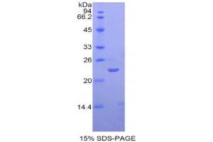 Image no. 1 for Sialic Acid Binding Ig-Like Lectin 12 (SIGLEC12) (AA 317-512) protein (His tag) (ABIN1877928)