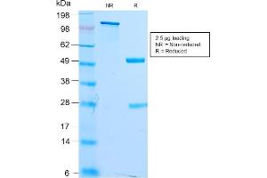 Image no. 1 for anti-Microphthalmia-Associated Transcription Factor (MITF) antibody (ABIN6940051)