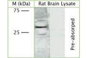 Image no. 1 for anti-Vacuolar-sorting Protein SNF8 (SNF8) (Internal Region) antibody (ABIN351332)