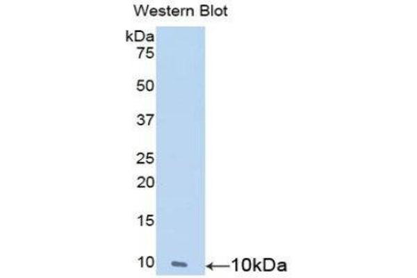 anti-Nesfatin-1 (NES1) (AA 25-106) antibody