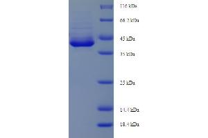 Image no. 1 for Apoptosis Enhancing Nuclease (AEN) (AA 117-325), (partial) protein (His-SUMO Tag) (ABIN5711525)