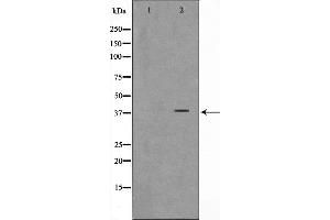 Image no. 1 for anti-Armadillo Repeat Containing, X-Linked 3 (ARMCX3) (N-Term) antibody (ABIN6260044)