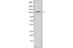 Image no. 2 for anti-Actinin, alpha 3 (ACTN3) (N-Term) antibody (ABIN6258681)