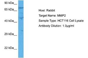 Image no. 5 for anti-Matrix Metalloproteinase 2 (MMP2) (C-Term) antibody (ABIN2792308)