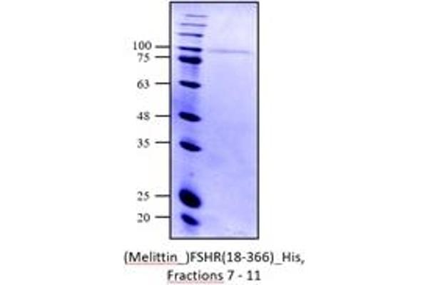FSHR Protein (AA 18-366) (His tag)