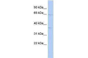 Image no. 1 for anti-KIAA1191 (KIAA1191) (Middle Region) antibody (ABIN2786623)