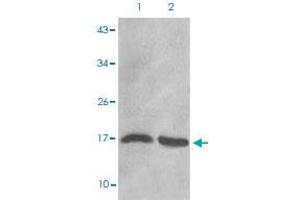 Image no. 2 for anti-Histone Cluster 1, H3d (HIST1H3D) (2meLys27) antibody (ABIN5579861)