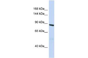Image no. 1 for anti-Histocompatibility (Minor) HA-1 (HMHA1) (N-Term) antibody (ABIN2785932)
