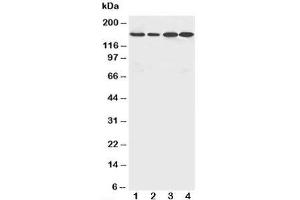 Image no. 2 for anti-rho-Associated, Coiled-Coil Containing Protein Kinase 2 (ROCK2) (N-Term) antibody (ABIN3032472)