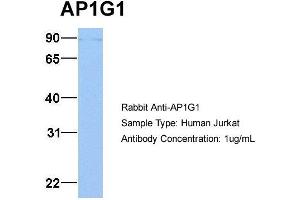 Image no. 3 for anti-Adaptor-Related Protein Complex 1, gamma 1 Subunit (AP1G1) (C-Term) antibody (ABIN2784689)