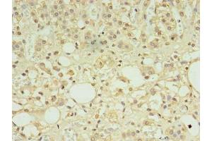 Immunohistochemistry of paraffin-embedded human adrenal gland tissue using ABIN7165434 at dilution of 1:100