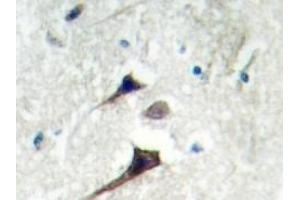Image no. 1 for anti-14-3-3 epsilon (YWHAE) antibody (ABIN272265)