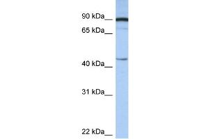anti-Proteasome (Prosome, Macropain) 26S Subunit, Non-ATPase, 6 (PSMD6) (N-Term) antibody