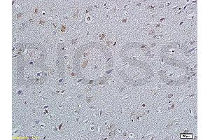 Image no. 1 for anti-Glucosidase, Alpha, Neutral AB (GANAB) (AA 428-540) antibody (ABIN720445)